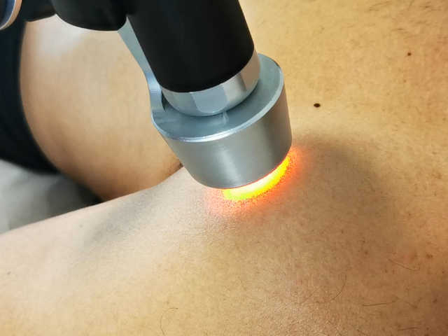 Che cos’è la laserterapia